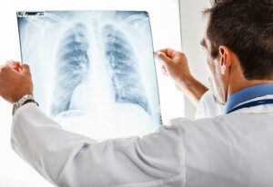 Akciğer kanserinde hastalığın evresi neden önemlidir?